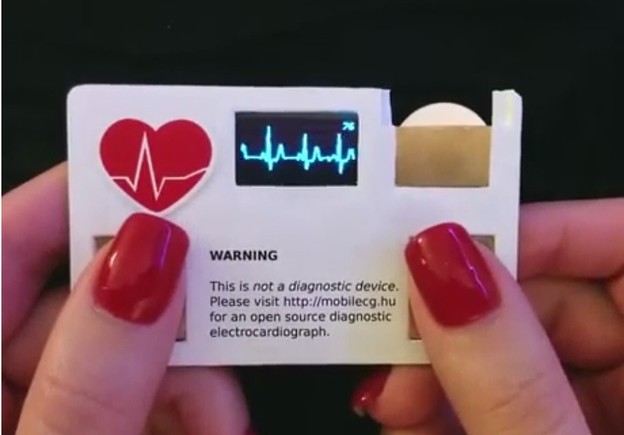 VIDEO: Vizitka sa stvarnim EKG-om