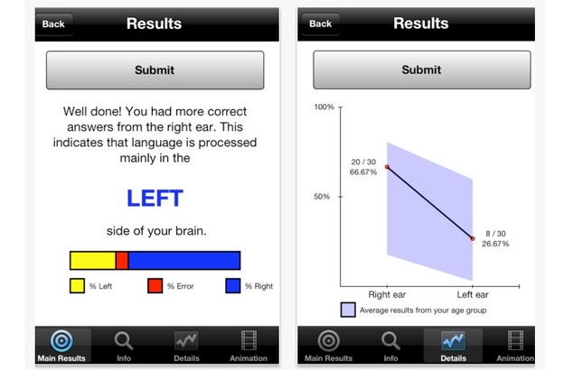 iPhone aplikacija pomaže u istraživanjima mozga