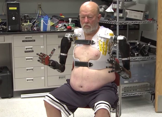 VIDEO: Prvi čovjek na svijetu s dvije bioničke ruke