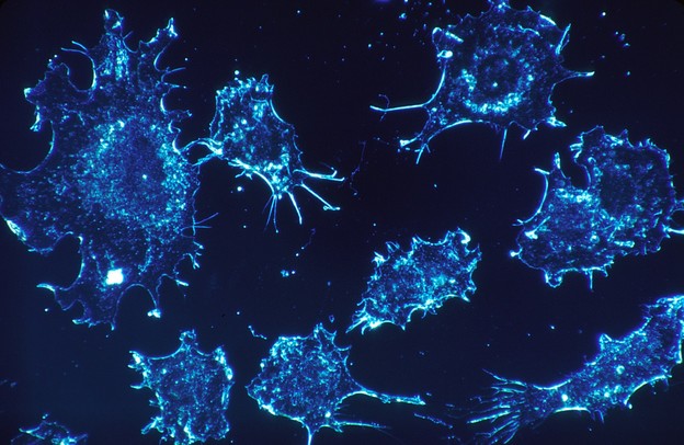 Znanstvenici su možda otkrili prekidač za rak