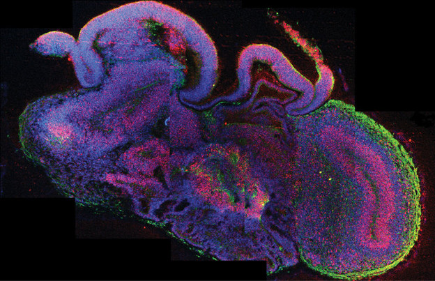 Znanstvenici uzgojili 3D tkivo ljudskog mozga