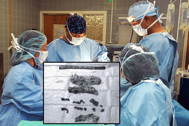 Kirurzi zaboravili 16 predmeta u tijelu pacijenta