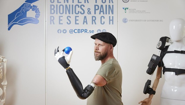 Revolucionarna bionička šaka vraća kvalitetu života