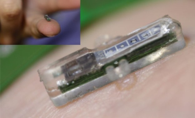 VIDEO: Implantat šalje krvne pretrage na vaš mobitel