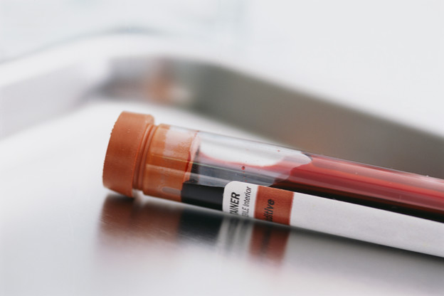 WHO želi zabraniti opasne testove krvi