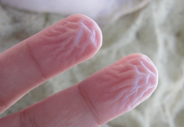 Wnt protein regenerira amputirane prste