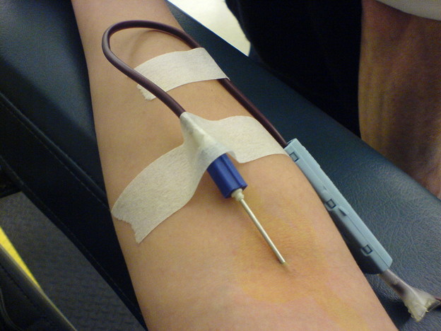 Bolnica odbila primiti krv od lezbijke