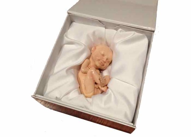 3D isprintani fetusi po narudžbi