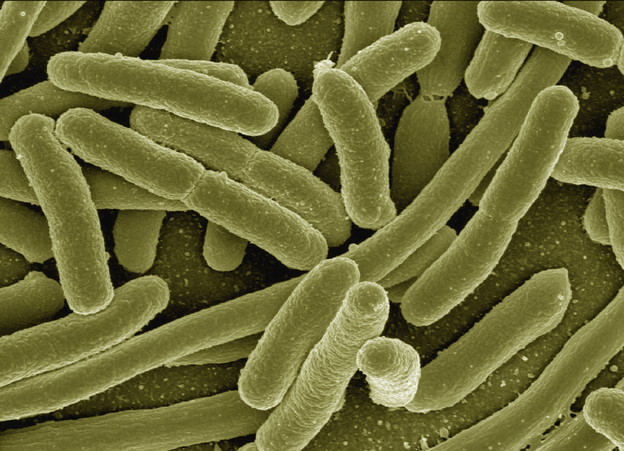 Escherichia coli koja jede CO2 Escherichia coli koja jede CO2