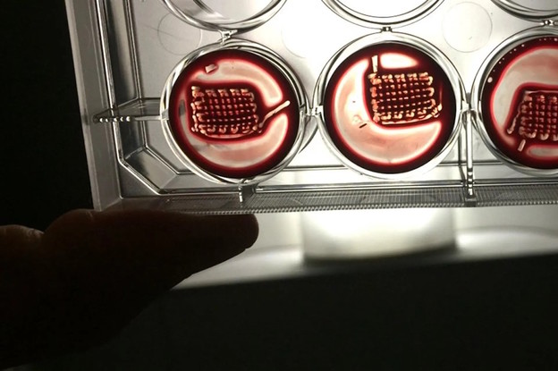 Implantati napravljeni od krvi popravljaju kosti Implantati napravljeni od krvi popravljaju kosti