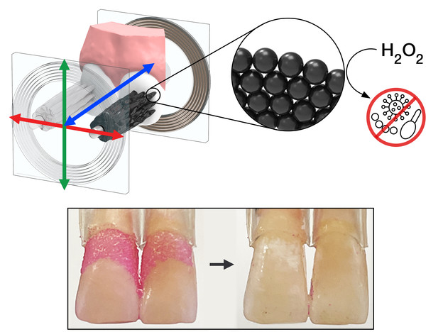 Mikrobotovi mogu četkati i čistiti zube