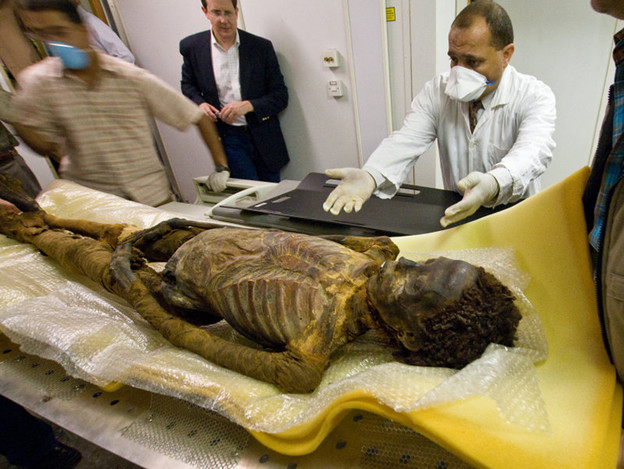 Mumija sa srčanom manom