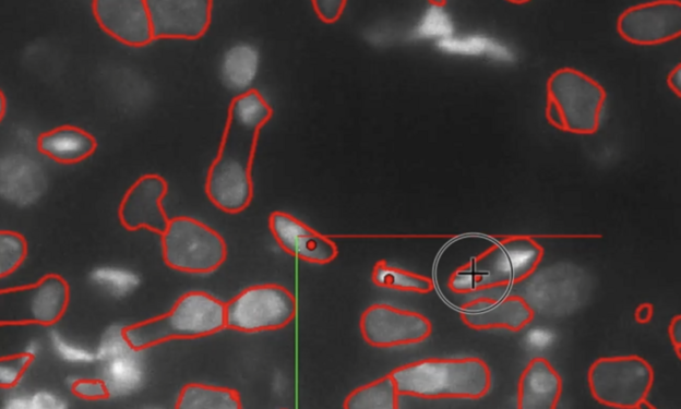NeuroTrALE je novi alat za mapiranje mozga NeuroTrALE je novi alat za mapiranje mozga