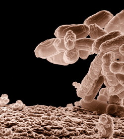 Novi antibiotik ubija desetke najjačih superbakterija