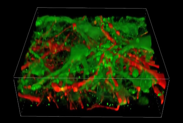 Prvi 3D isprint funkcionalnog tkiva ljudskog mozga
