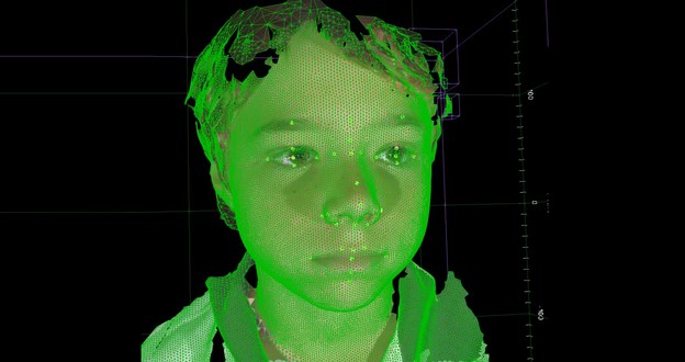 3D mapiranje otkriva rijetke bolesti kod djece 3D mapiranje otkriva rijetke bolesti kod djece