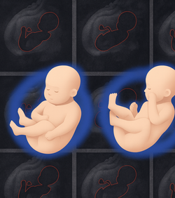 AI alat za detaljniju 3D sliku zdravlja fetusa