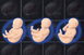 AI alat za detaljniju 3D sliku zdravlja fetusa