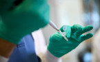 FDA odobrava krvni test za Alzheimerovu bolest FDA odobrava krvni test za Alzheimerovu bolest