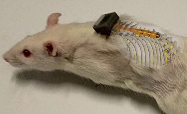 Implantat omogućuje hodanje paraliziranom štakoru Implantat omogućuje hodanje paraliziranom štakoru
