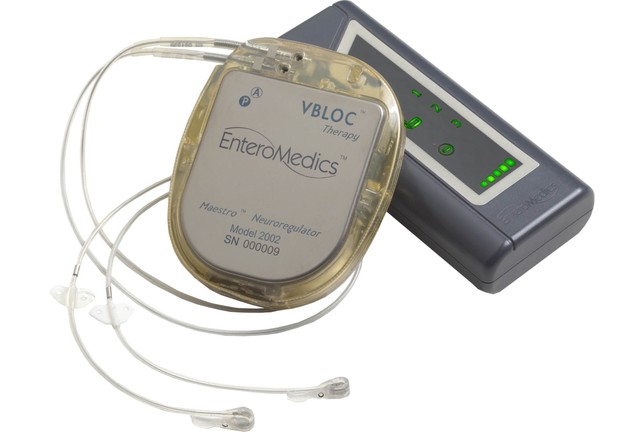 Legaliziran prvi elektronski implantat za mršavljenje Legaliziran prvi elektronski implantat za mršavljenje
