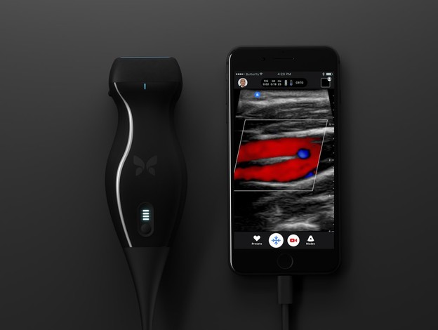 Medicinski ultrazvučni skener za pametni telefon Medicinski ultrazvučni skener za pametni telefon