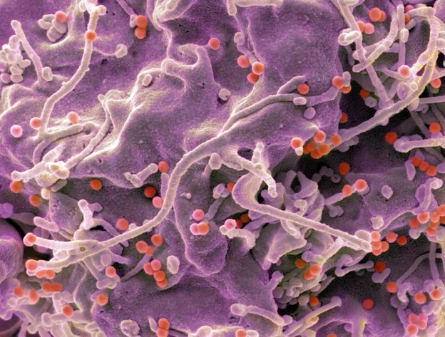 mRNA cjepiva za HIV pokazuju dobre rezultate mRNA cjepiva za HIV pokazuju dobre rezultate