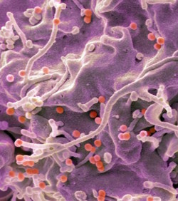 mRNA cjepiva za HIV pokazuju dobre rezultate