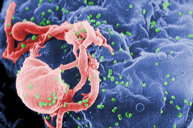 Otkriven gel koji blokira virus HIV-a