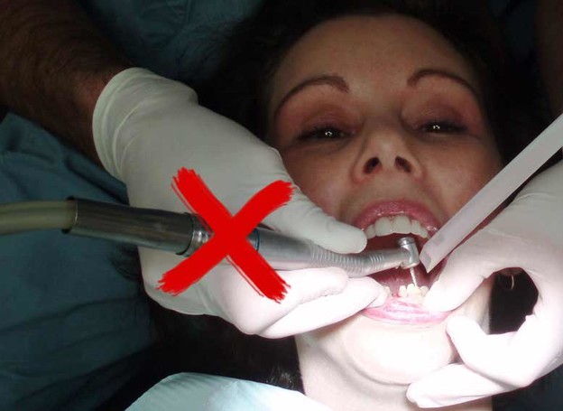 Popravak zuba bez bušilice