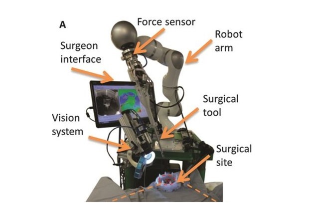 Robot će vas zašiti bolje od kirurga