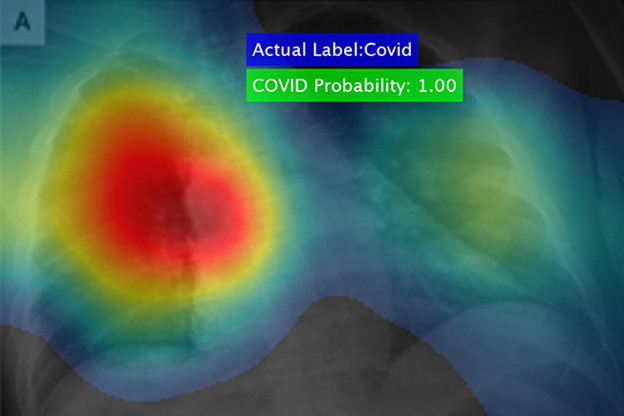Softver otkriva koronavirus u sekundama