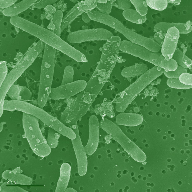 Španjolska odbila odštetu za E.coli Španjolska odbila odštetu za E.coli