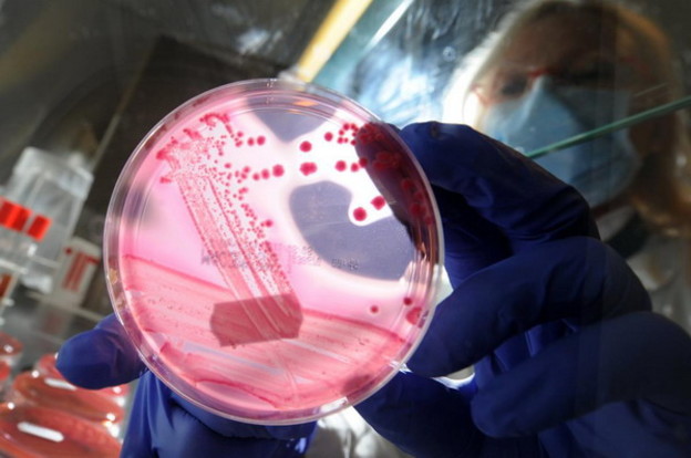 Splitski lijek protiv E. coli tek za 7 godina Splitski lijek protiv E. coli tek za 7 godina
