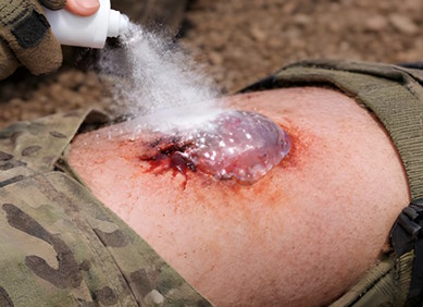 Sprej zaustavlja krvarenje na bojišnici u sekundi