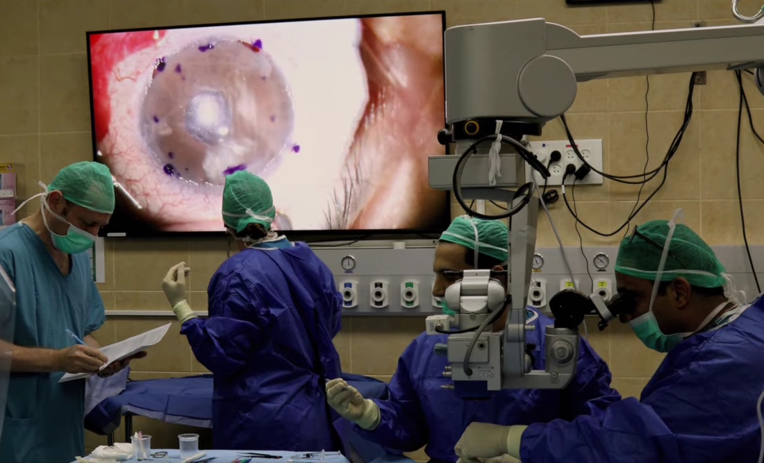 VIDEO: 3D printana rožnica vratila vid pacijentici