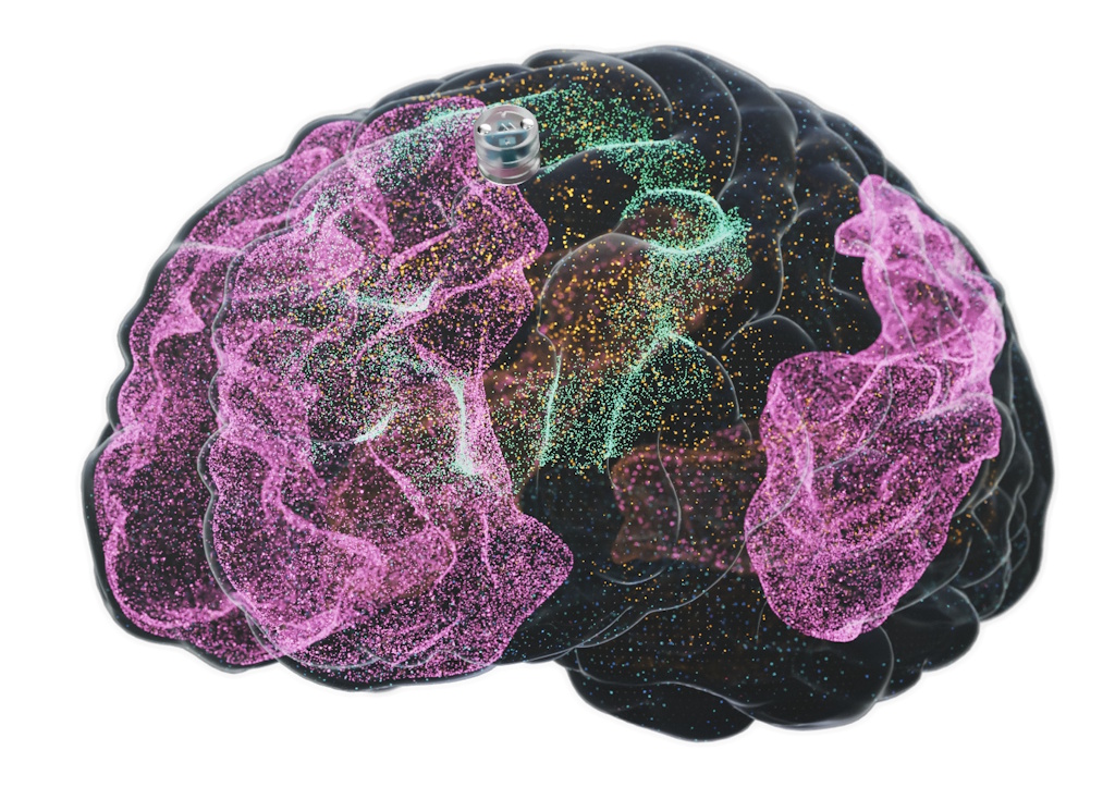 VIDEO: Implantat za liječenje mentalnih bolesti