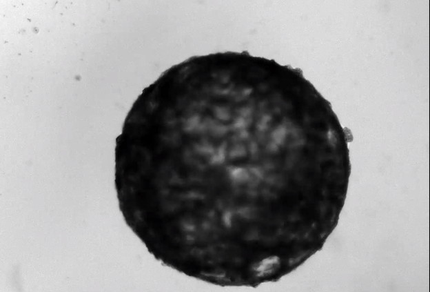 VIDEO: Laboratorijski uzgojena mini srca kucaju kao prava VIDEO: Laboratorijski uzgojena mini srca kucaju kao prava