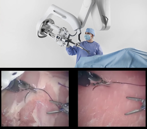 VIDEO: Robot uči operirati iz videa VIDEO: Robot uči operirati iz videa