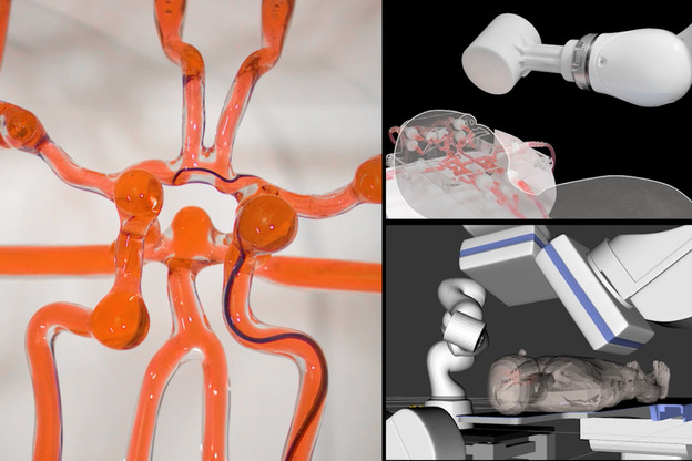 VIDEO: Robot za endovaskularne intervencije na daljinu