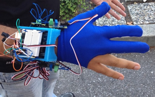 VIDEO: Ultrazvučna rukavica za pregled grudi
